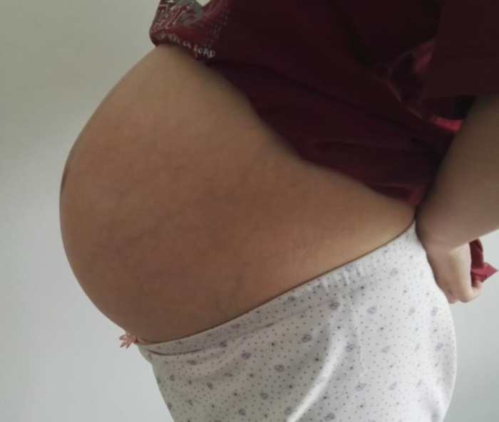 一层层,一刀刀切开孕妇肚子,剖腹产并不是你想象的那么简单