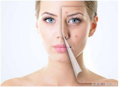 解决身体湿气的中药方子,身体湿气重吃什么药最好最快排湿