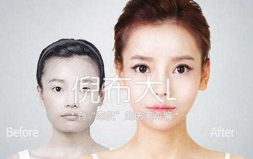 削骨整形的最佳方法,磨骨整形和削骨