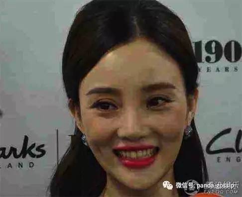 李小璐原来的双眼皮,李小璐双眼皮变脸视频