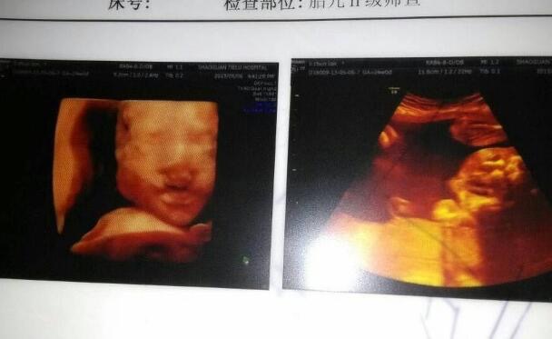 孕期检查发现宝宝有问题咋办,孕期检查出胎儿有缺陷怎么办