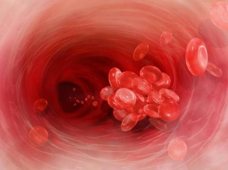 血稠吃什么药通血管有效,血稠吃什么食物能清理血管垃圾