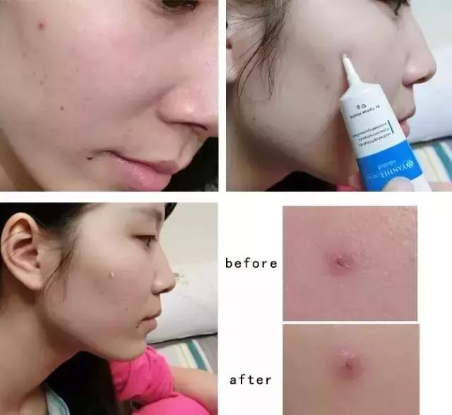 到了泰国买什么比较好,去泰国旅游买青草膏