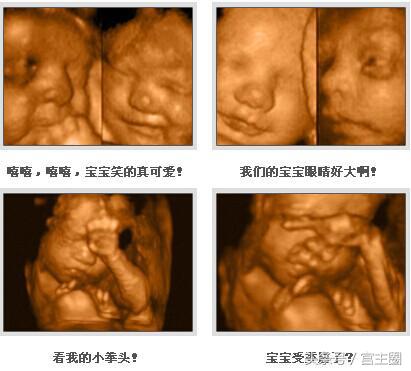 孕期四维彩超最佳时间,孕期四维彩超什么时候做