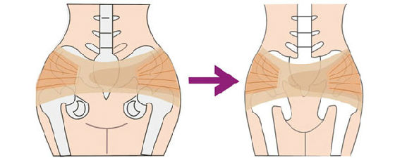 产后骨盆修复推拿手法教程,御众堂产后骨盆修复怎么样