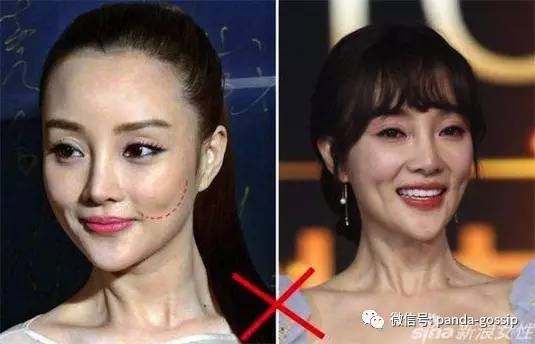 李小璐原来的双眼皮,李小璐双眼皮变脸视频