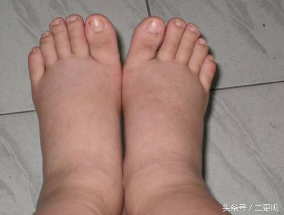 怀孕后爱吃咸的怎么回事,孕期口味加重