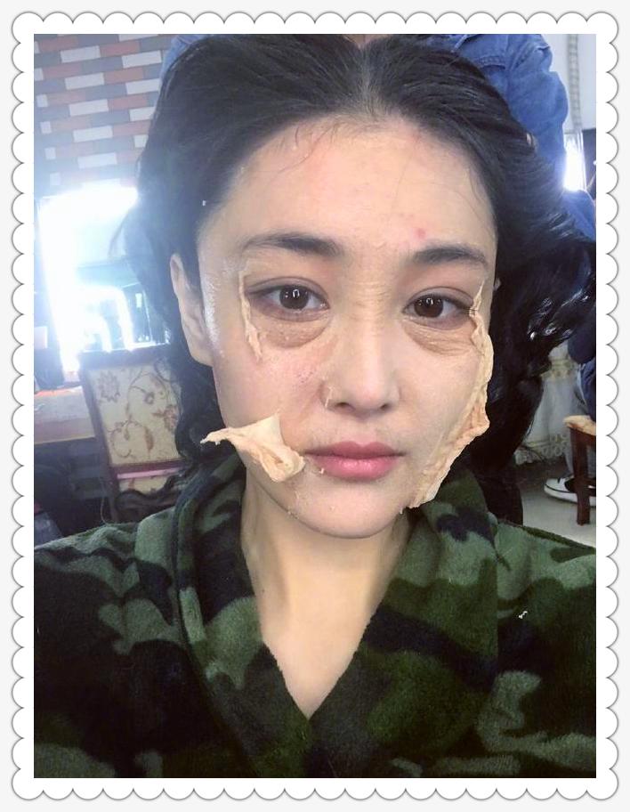 钟丽缇美白针,钟丽缇刮痧脸部