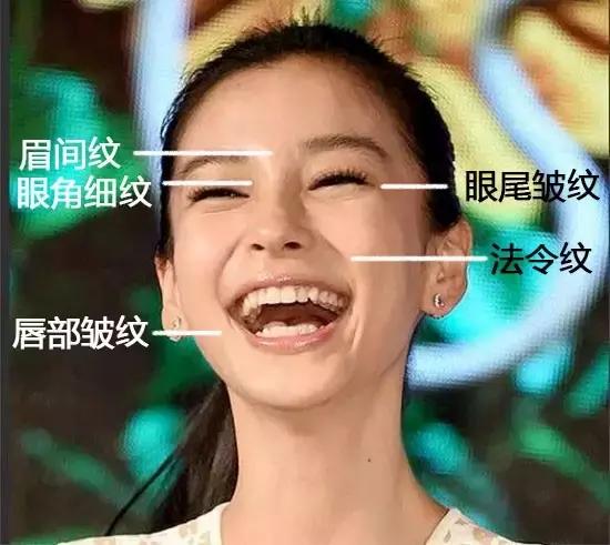 表情纹严重怎么去除,有几个方法处理抬头纹