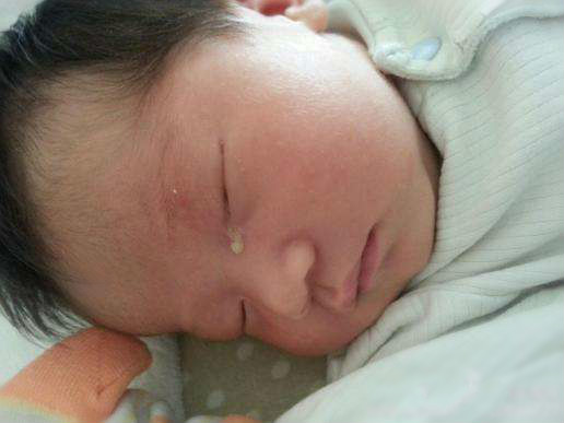 宝宝眼屎黄多是不是上火了,宝宝眼屎多且黄还粘稠怎么回事