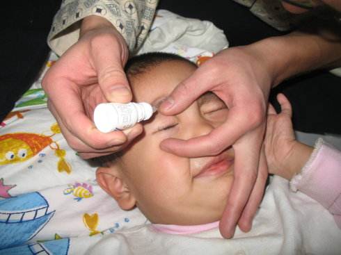 宝宝眼屎黄多是不是上火了,宝宝眼屎多且黄还粘稠怎么回事