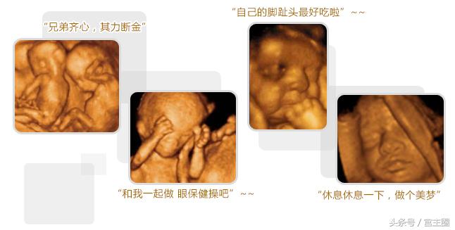 孕期四维彩超最佳时间,孕期四维彩超什么时候做