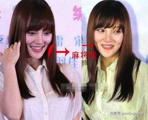 李小璐原来的双眼皮,李小璐双眼皮变脸视频
