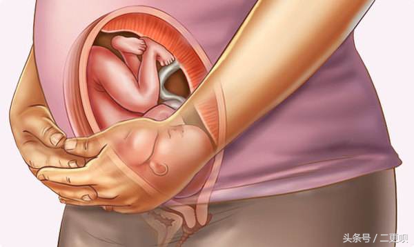 孕妈都担心羊水破?羊水破的问题看这篇你肯定就知道怎么做了