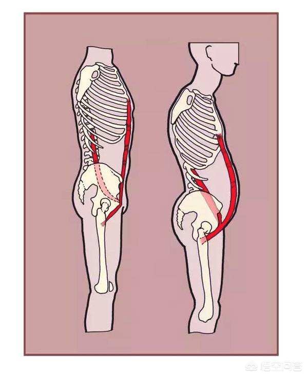 腰疼做燕飞操怎么做,腰疼做小燕飞的姿势可以么