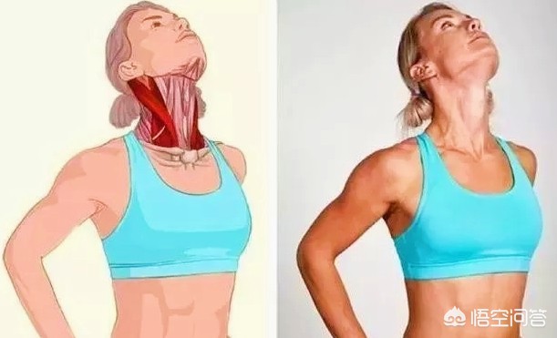 颈椎病患者如何选用枕头,神经型颈椎病枕高枕头还是低枕头