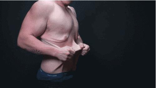 减肥后脸上皮肤松弛大概多久恢复,肚子减肥后皮肤松弛下垂怎么办