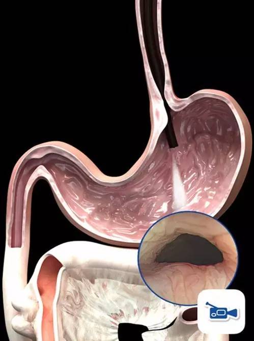 D136-狗吐了一只鞋,还有三只消失了,怎么破?