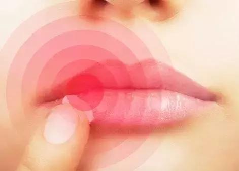 外出踏青要注意什么安全,清明踏青皮肤过敏