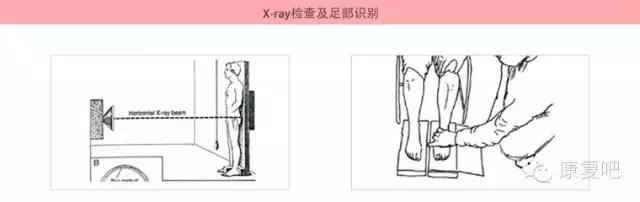 VIC健身：X型腿的矫正训练