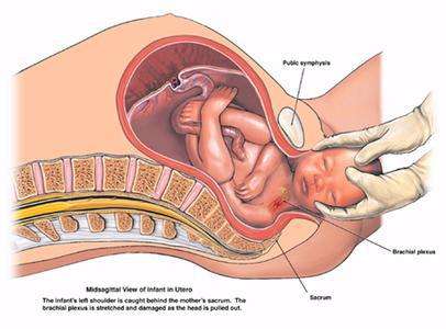 自然分娩技巧训练,第二产程胎儿的娩出过程是什么
