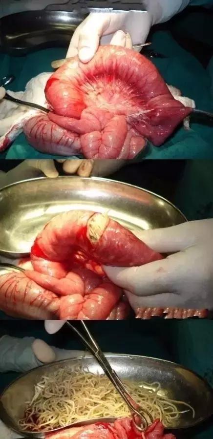 检查宝宝肚子里有虫,宝宝体检蛔虫