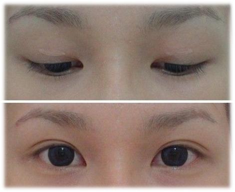 你是什么眼形？下面的方法让你秒变双眼皮大眼睛