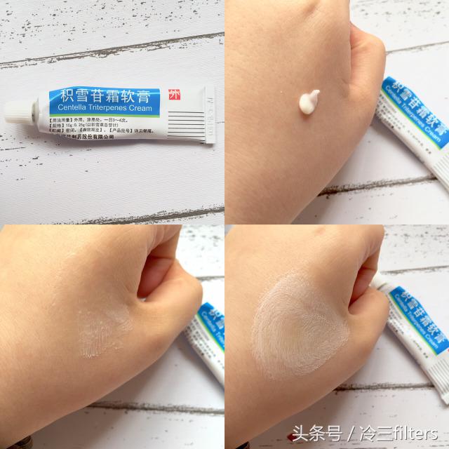 长痘痘痘印用什么祛痘产品好学生,祛痘痘祛痘印最有效的产品推荐