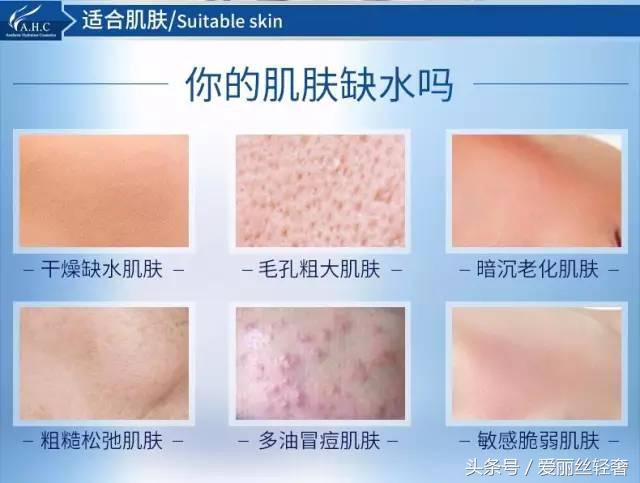 ahc新款B5玻尿酸水乳怎么样,补水保湿ahc测评