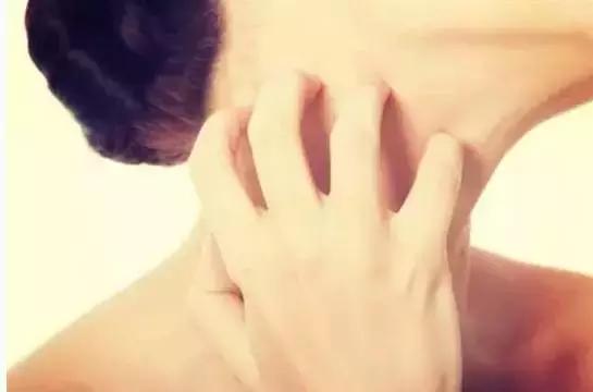 过敏荨麻疹是怎么来的,过敏性荨麻疹如何得的