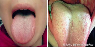 你有口臭怎么解决,你有口臭说明什么