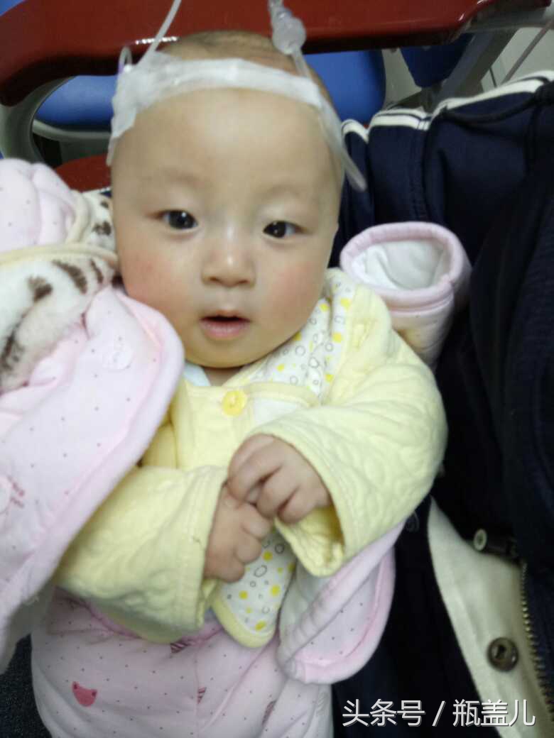 4个月的宝宝支气管炎需要住院吗,4个月的宝宝支气管炎要住院吗