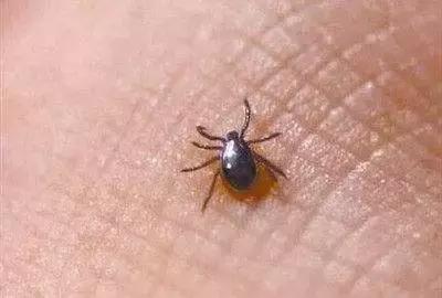 外出踏青要注意什么安全,清明踏青皮肤过敏