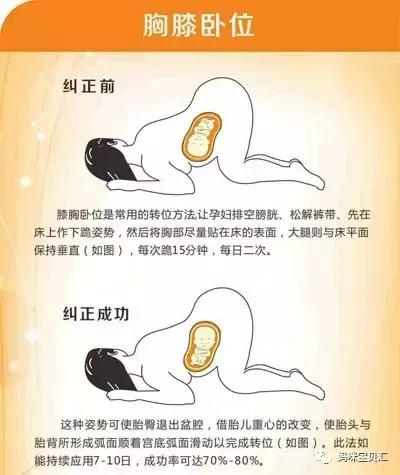 胎位不正导致难产首选的助产方法,胎位不正会有什么危险