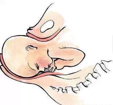 自然分娩技巧训练,第二产程胎儿的娩出过程是什么