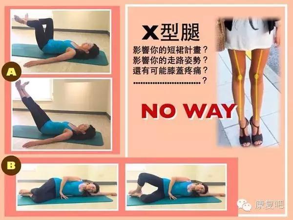 VIC健身：X型腿的矫正训练