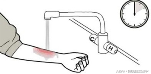 美国烧伤修复手段,红十字会烧烫伤现场处理操作视频