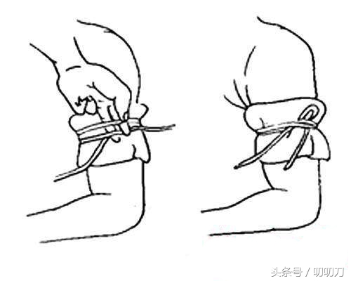 被刀割伤时的几个简易止血方法,关键时刻或许可以救命!
