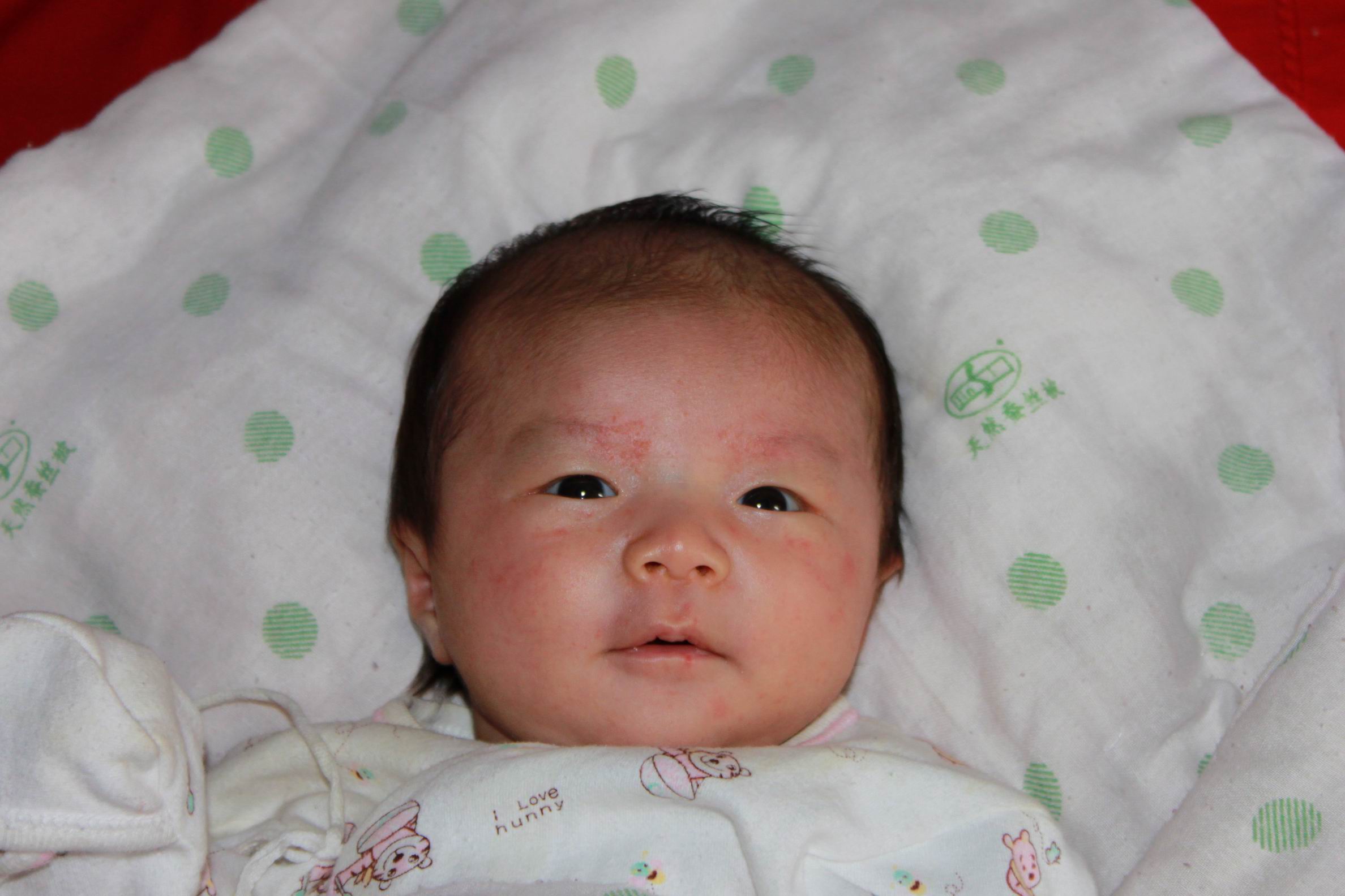 新生儿头发发黄秃鬓角,新生儿头发稍发黄是什么原因