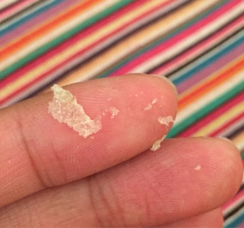 头皮屑到底是什么啊,原来头皮屑是怎么来的