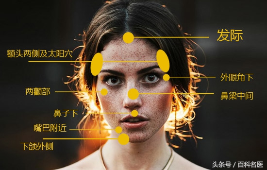 眼角和太阳穴长斑是怎么回事,眼角长斑的原因