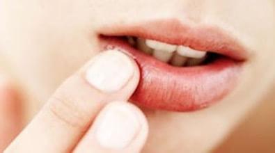 嘴巴起泡是什么引起的上火,嘴巴起泡是犯小人吗