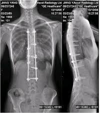 收藏这篇就够了,x光b超ct核磁共振图片区别