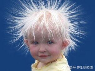 七岁孩子每天掉多少根头发正常,你每天掉多少根头发