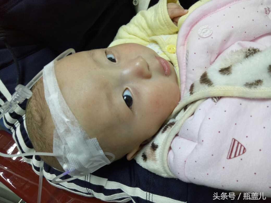 4个月的宝宝支气管炎需要住院吗,4个月的宝宝支气管炎要住院吗