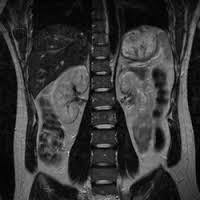 收藏这篇就够了,x光b超ct核磁共振图片区别