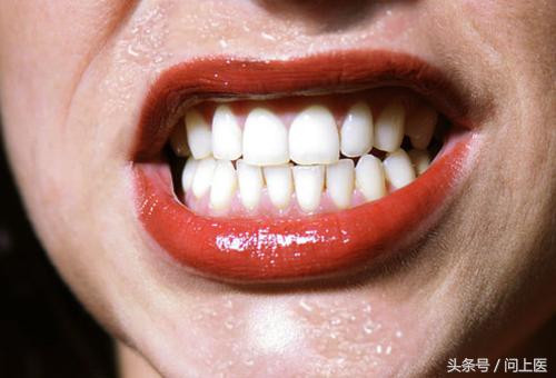 以前不出汗现在开始很容易出汗,为什么有人出汗多有的出汗少