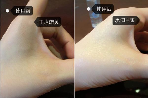 玻尿酸多少钱一瓶,玻尿酸多少钱一瓶才是正品