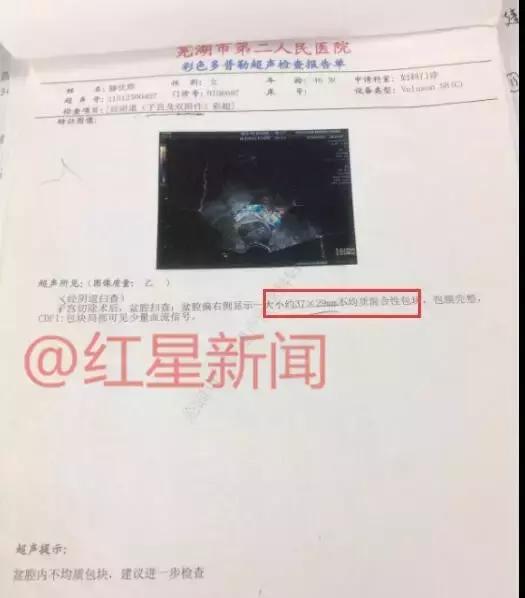 红星调查,红星调查最新视频