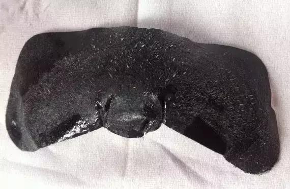 拒绝草莓鼻让你和黑头说再见,草莓鼻搞定黑头其实也没那么难